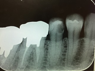 c95dd084285b59a6934be120f0fc89a874ea5244.jpgのサムネイル画像